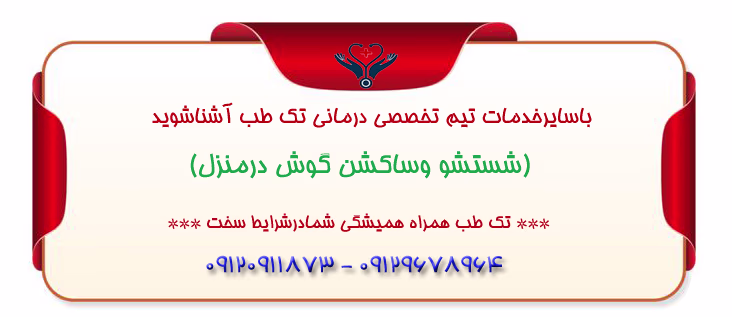 نصب سونددرمنزل