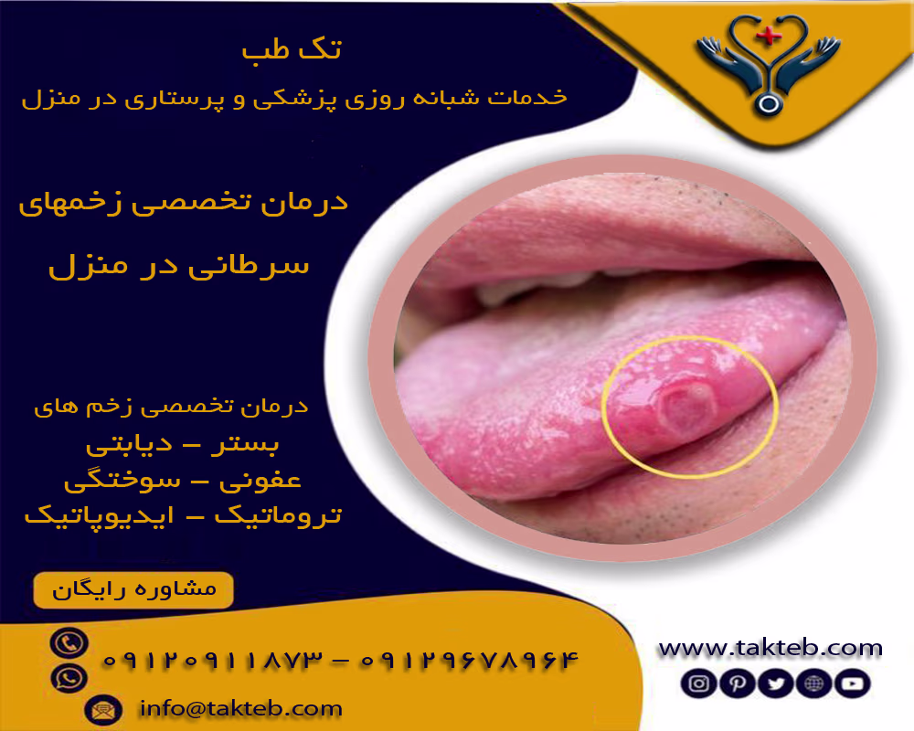 درمان زخم سرطانی در منزل