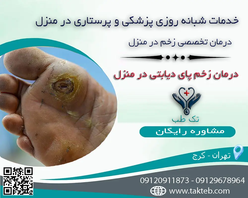 درمان زخم پای دیابتی